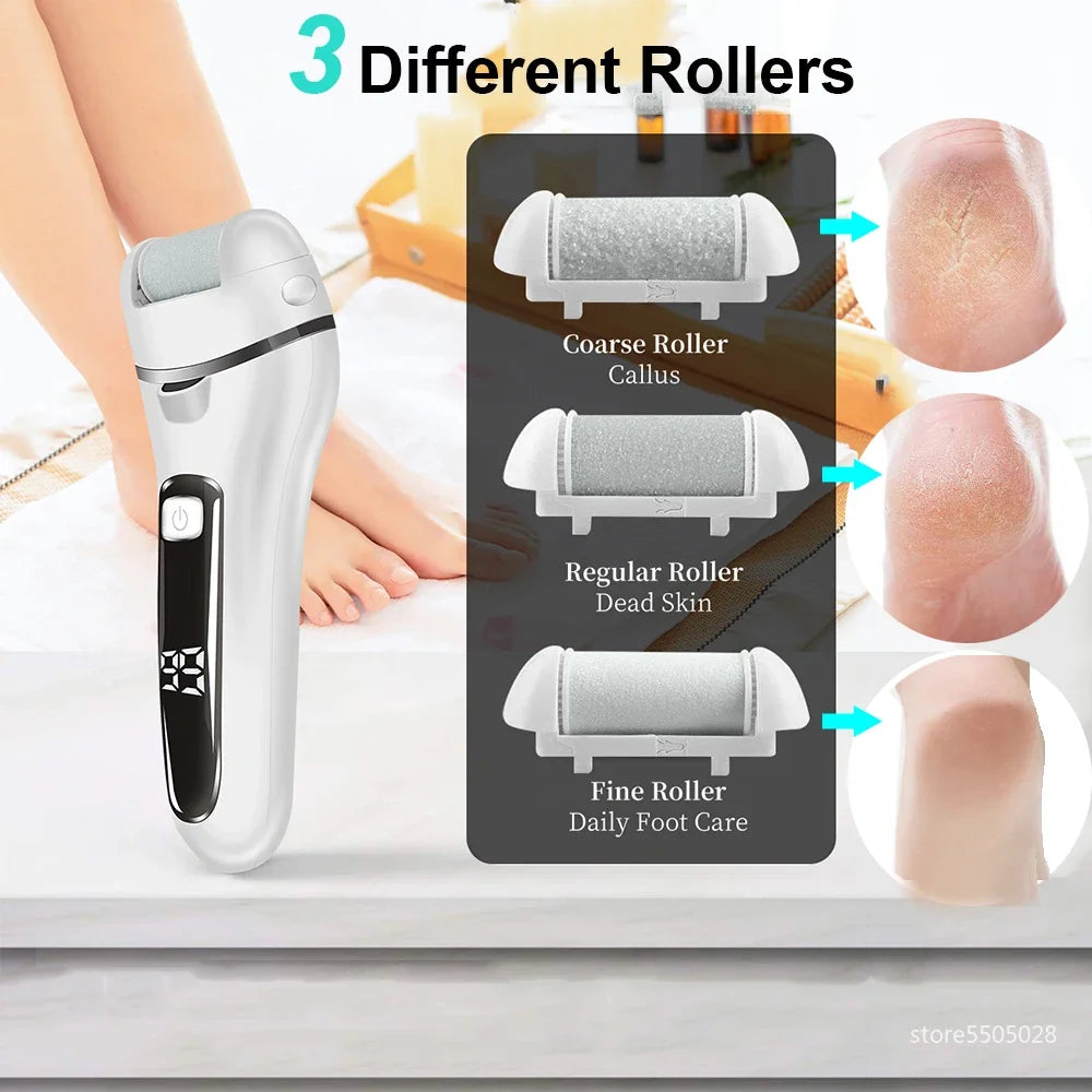 Rechargeable Electric Callus Remover – Pro Foot File & Pedicure Tool