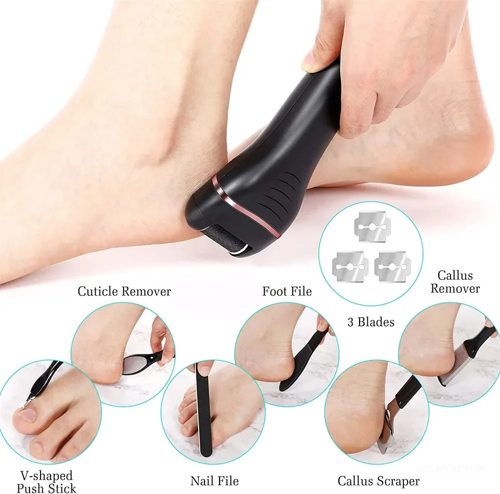 Rechargeable Electric Callus Remover – Pro Foot File & Pedicure Tool